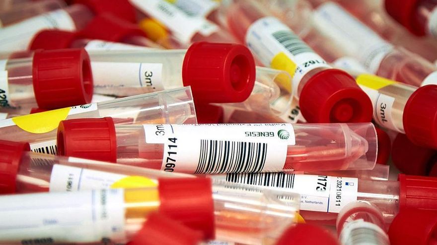 Fewer infections, fewer active cases and fewer covid hospitalisations in Ibiza