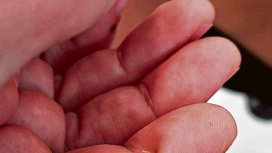 Tamara, patient from Ibiza: “I have been waiting a month and a half for Traumatology to remove a cactus spike that is piercing my finger”