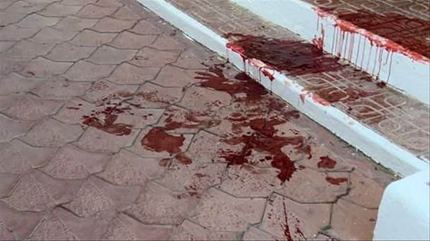 British tourist assaulted and stabbed on Ibiza